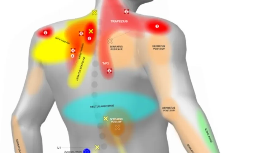 Cómo entender y tratar el dolor de espalda gracias al mapa corporal