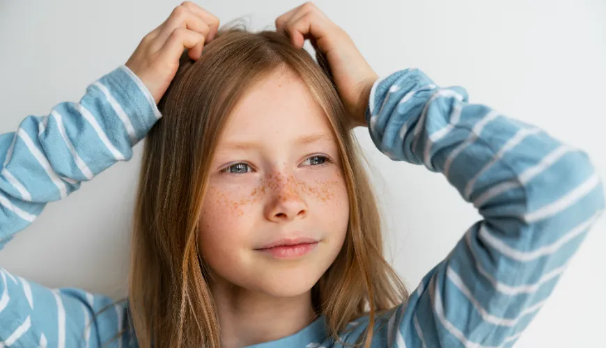 Guía práctica para eliminar liendres del cabello